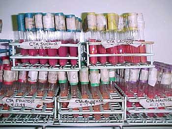 Microbioligy lab tools and vials